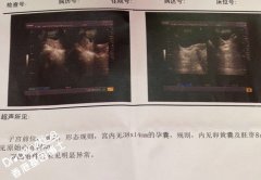 去香港验血要注意什么呢？