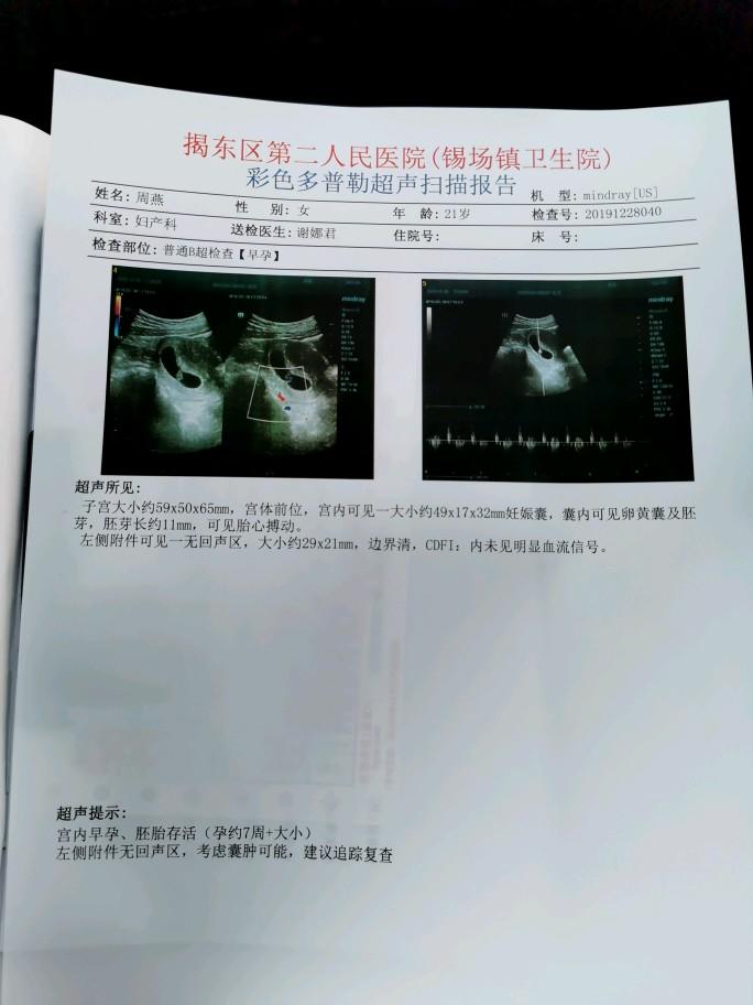 香港抽血检测男女性别准不？亲身经历详细攻略