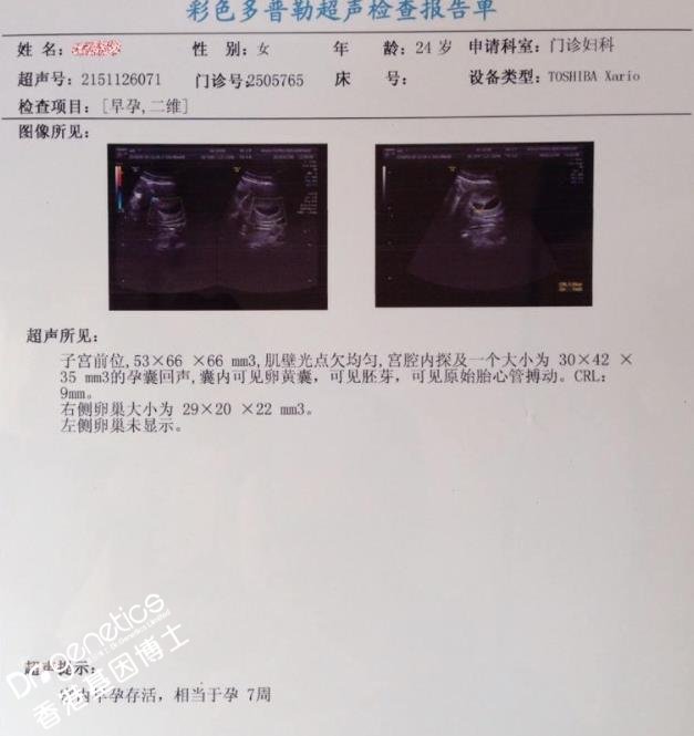 香港验血可以查出来怀孕多久吗
