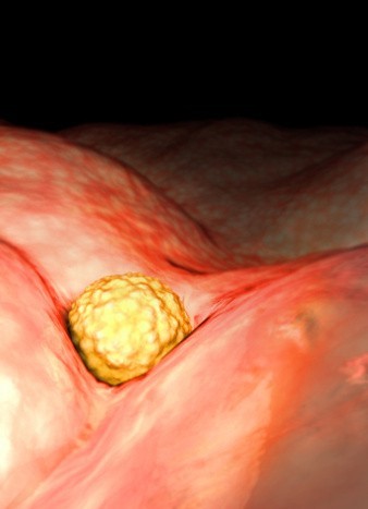 胎儿发育过程：胎儿性别的形成过程